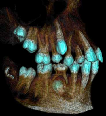 dvt-kfo-38.jpg